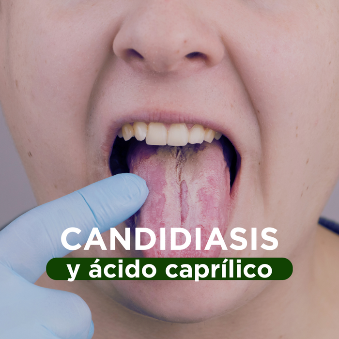 Candidiasis y tratamiento con Ácido Caprílico